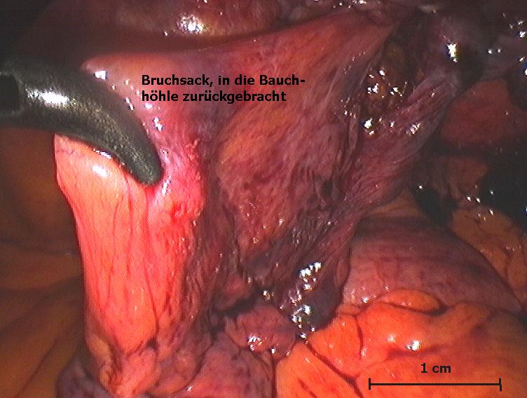 DIRBRUREP.jpg (77297 Byte)
